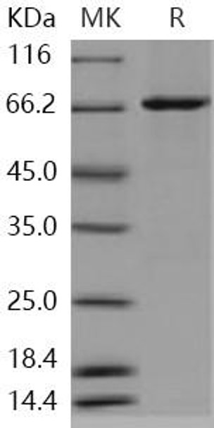 Human c-KIT/CD117 Recombinant Protein (RPES4197)