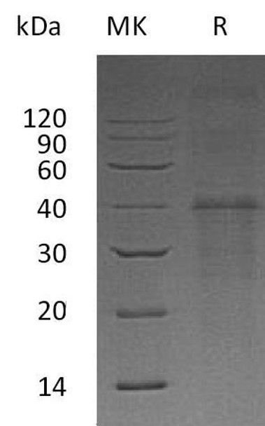 Carbonic Anhydrase 14/CA14 Recombinant Protein (RPES4205)
