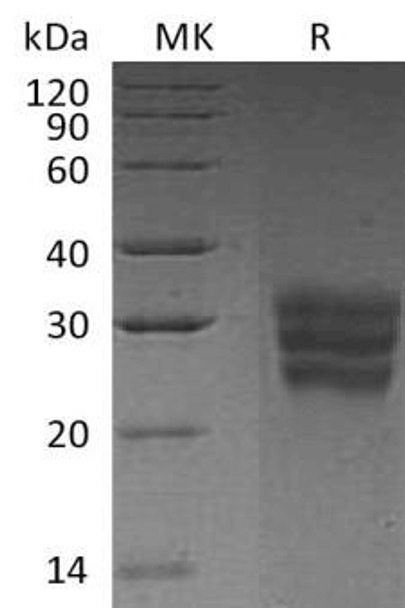 Human FLT3LG/Flt3 Ligand Recombinant Protein (RPES4206)