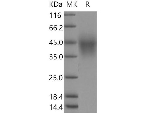 Human TMEM25 Recombinant Protein (RPES4220)