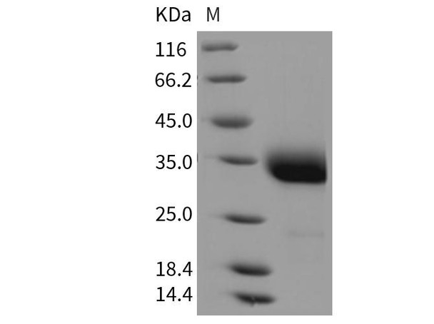 Rat Layilin/LAYN Recombinant Protein (RPES4232)