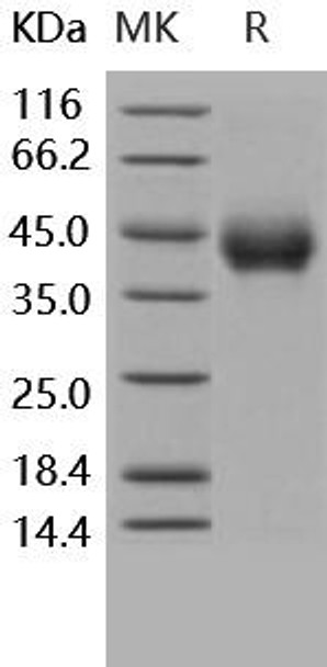 Human TNFRSF1B/CD120b Recombinant Protein (RPES4252)