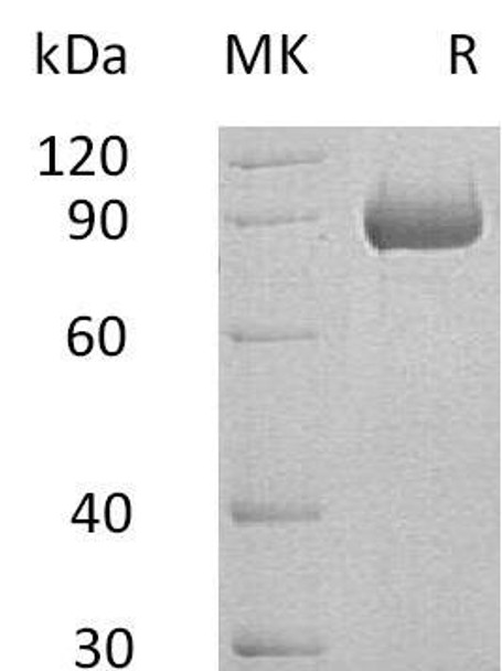 Human SEMA4B Recombinant Protein (RPES4256)