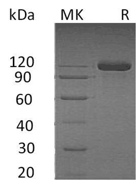 Human SEMA4B Recombinant Protein (RPES4281)