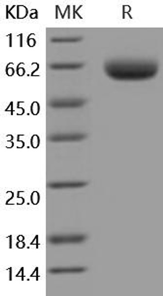 Mouse BACE1/ASP2 Recombinant Protein (RPES4283)
