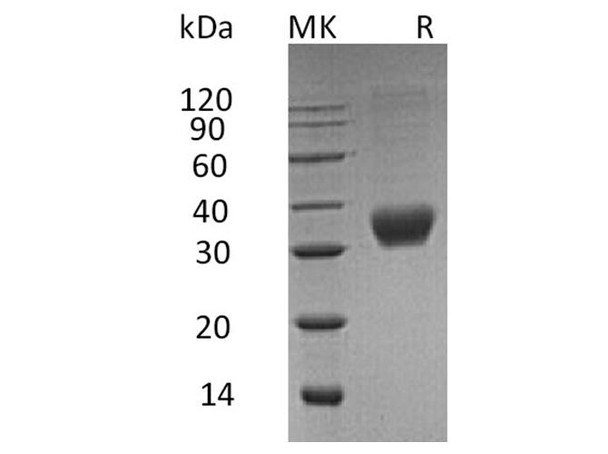 Human Fas/CD95/TNFRSF6 Recombinant Protein (RPES4290)