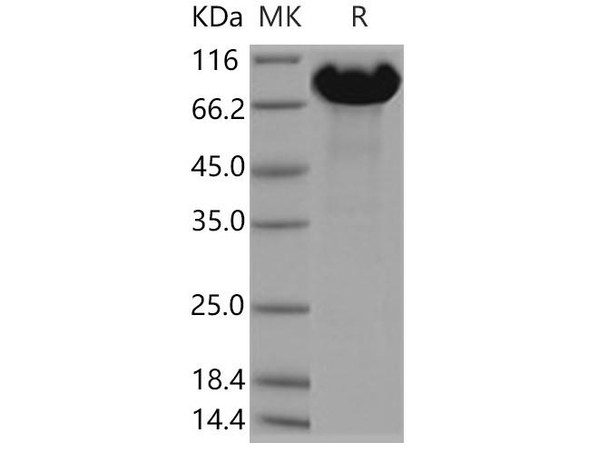 Human APLP Recombinant Protein (RPES4294)