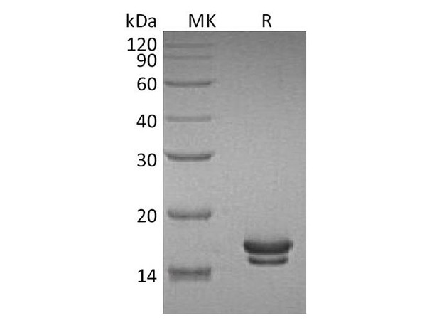 Rat Interleukin-2/IL-2 Recombinant Protein (RPES4317)