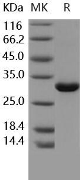 Human MBL2/MBL/COLEC1 Recombinant Protein (RPES4326)