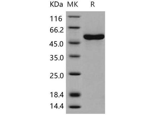 Human CCNA1/Cyclin-A1 Recombinant Protein (RPES4344)