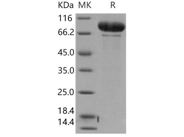 Human MMP-9 Recombinant Protein  (RPES4345)