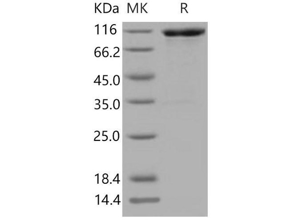 Mouse VCAM1 Recombinant Protein (RPES4348)