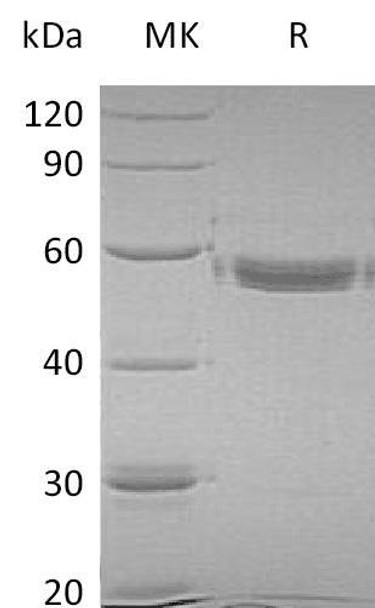 Human MMP1 Recombinant Protein (RPES4353)