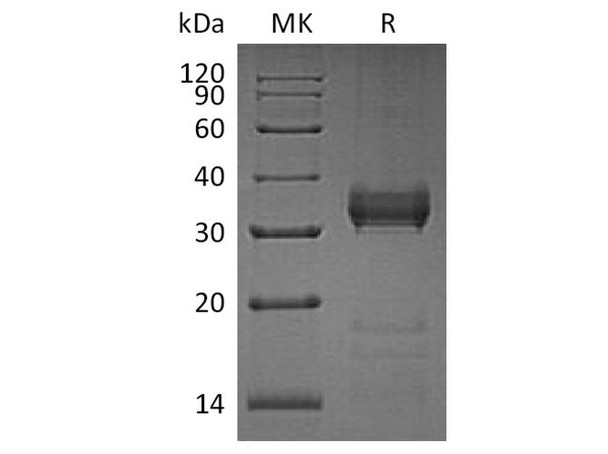 Human Kallikrein 13/KLK13 Recombinant Protein (RPES4363)