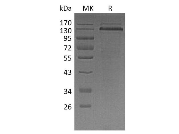 Human Thrombospondin/THBS1 Recombinant Protein (RPES4364)