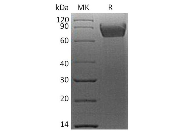 Human B7-H4/VTCN1 Recombinant Protein (RPES4365)