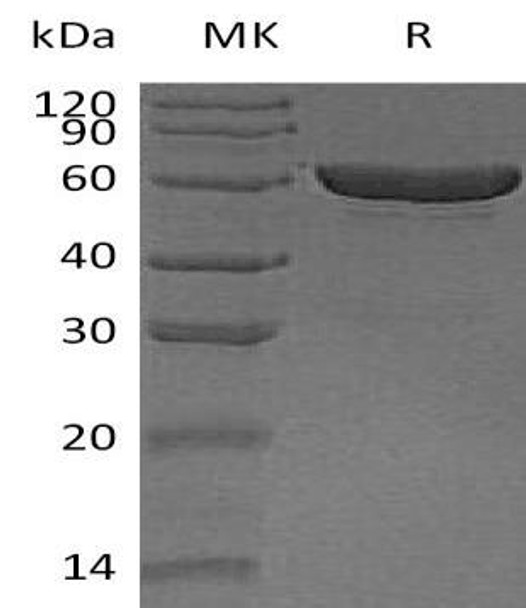 Carboxylesterase 1/CES1 Recombinant Protein (RPES4375)