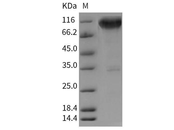 Rat TrkA/NTRK1 Recombinant Protein (RPES4379)