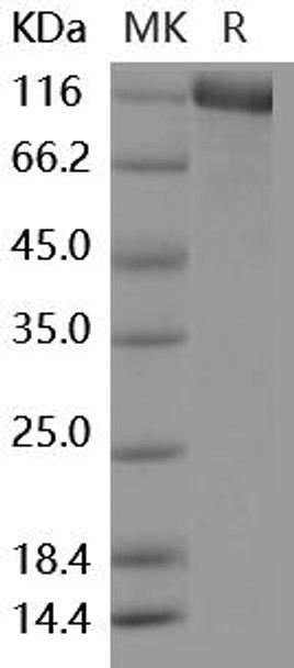 Mouse ENPEP/Aminopeptidase A Recombinant Protein (RPES4380)