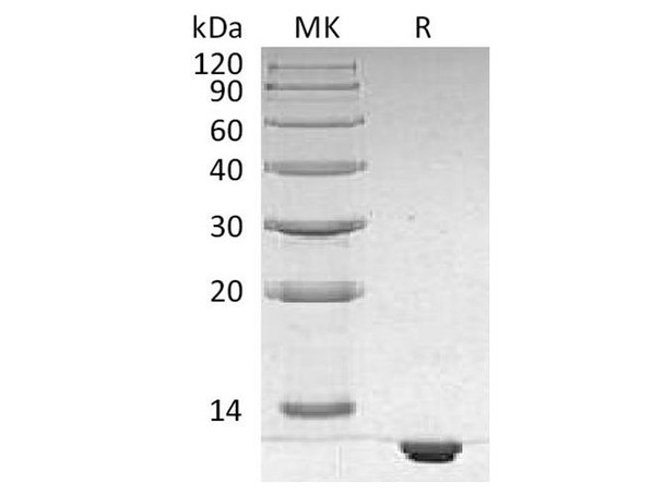 Human S100B Recombinant Protein (RPES4387)