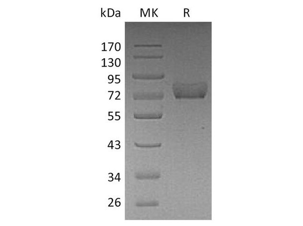 Human Thrombomodulin/CD141 Recombinant Protein (RPES4388)
