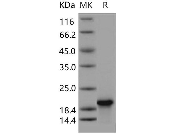 Human Troponin C/TNNC1 Recombinant Protein (RPES4392)