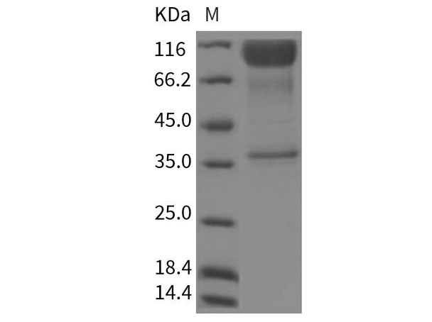 Rat IL23R/IL23 Receptor Recombinant Protein (RPES4403)