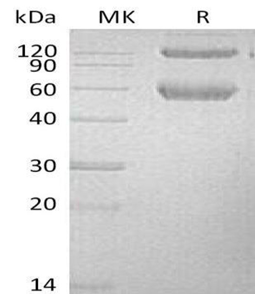 Mouse BMPRIA/ALK-3 Recombinant Protein (RPES4404)