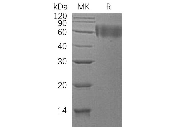 Human DR6/TNFRSF21 Recombinant Protein (RPES4410)