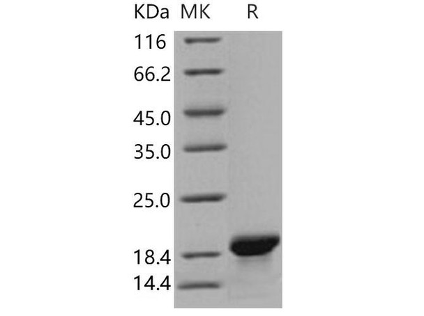 Human MOG Recombinant Protein (RPES4421)