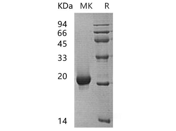 Human SENP7 Recombinant Protein (RPES4425)