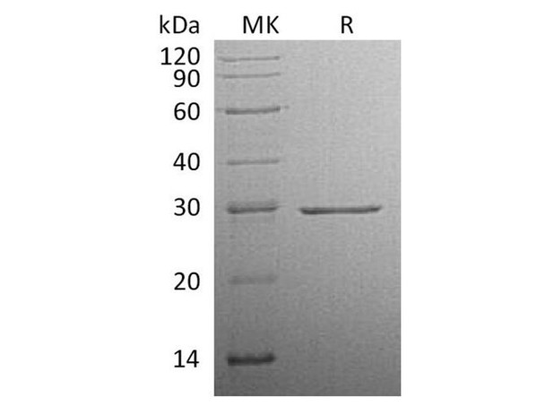 Human Factor D Recombinant Protein (RPES4432)