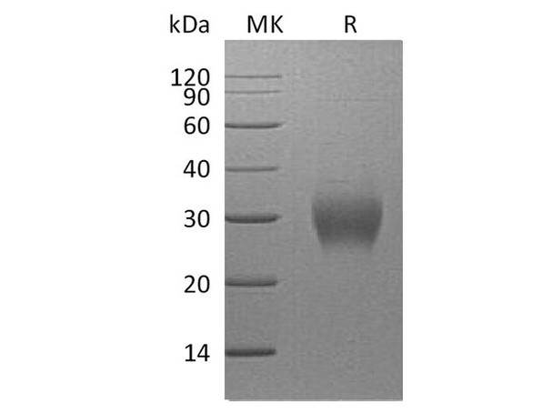 Human Fibrillin/FBN1 Recombinant Protein (RPES4434)