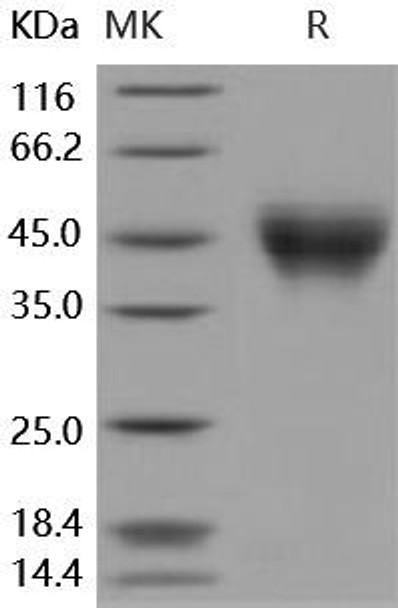 Human IFNAR2/IFNABR Recombinant Protein (RPES4442)