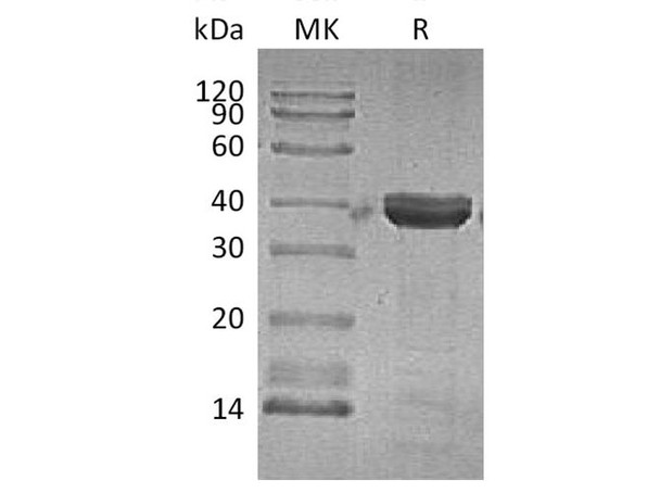 Human Cathepsin Z Recombinant Protein (RPES4454)