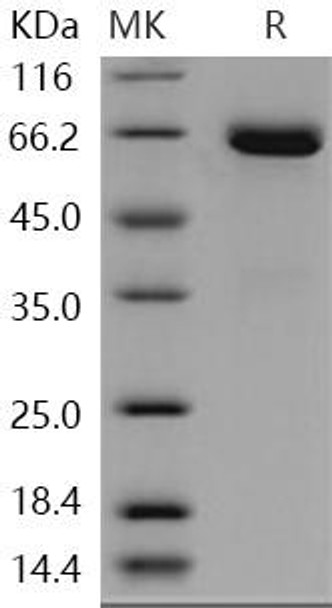 Human EphB1/EPHT2 Recombinant Protein (RPES4457)