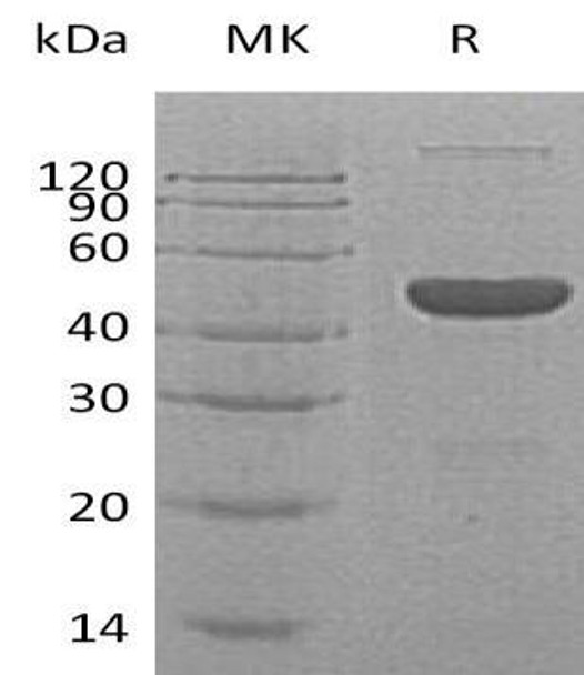 Human GABA Recombinant Protein (RPES4465)