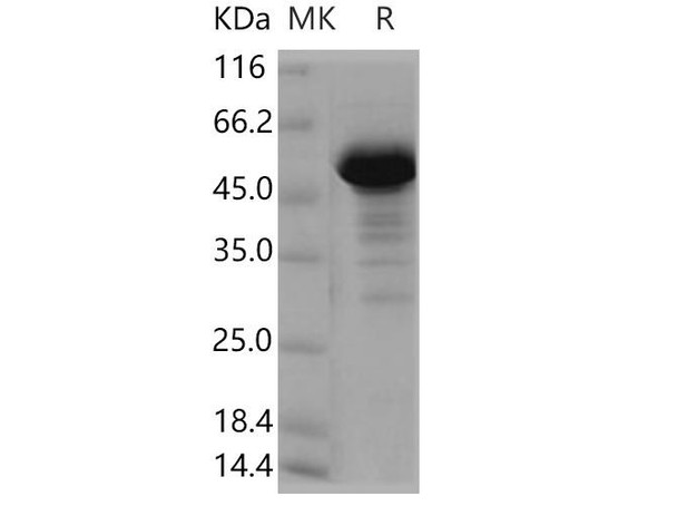 Human NCKIPSD/SPIN90 Recombinant Protein (RPES4478)