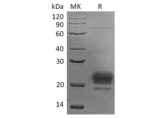 Human APOM Recombinant Protein (RPES4499)