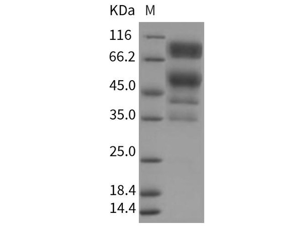 Rat CD55/DAF Recombinant Protein (RPES4503)