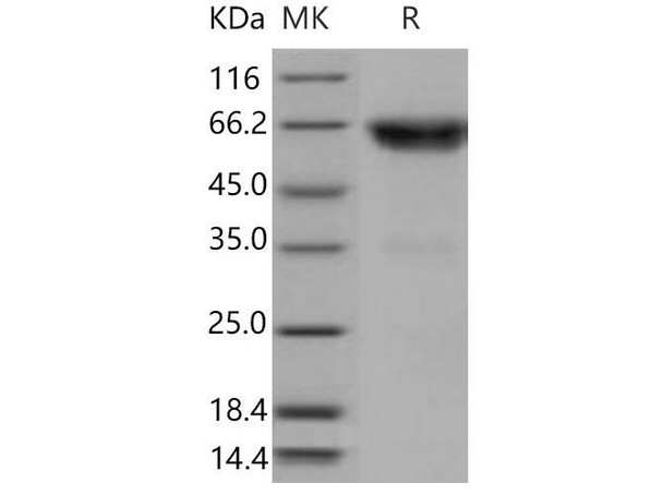 Mouse TNFRSF1B/CD120b Recombinant Protein  (RPES4505)