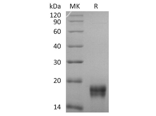 Human GADD45 beta/GADD45B Recombinant Protein (RPES4509)