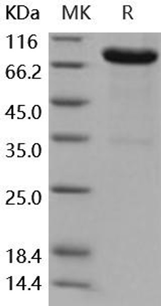 Mouse IL13RA2/CD213A2 Recombinant Protein (RPES4513)