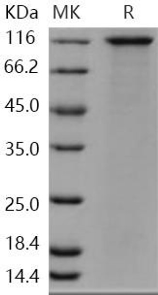 Human SorCS1 Recombinant Protein (RPES4523)