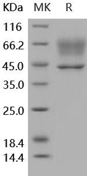 Human SerpinA3/AACT Recombinant Protein (RPES4546)