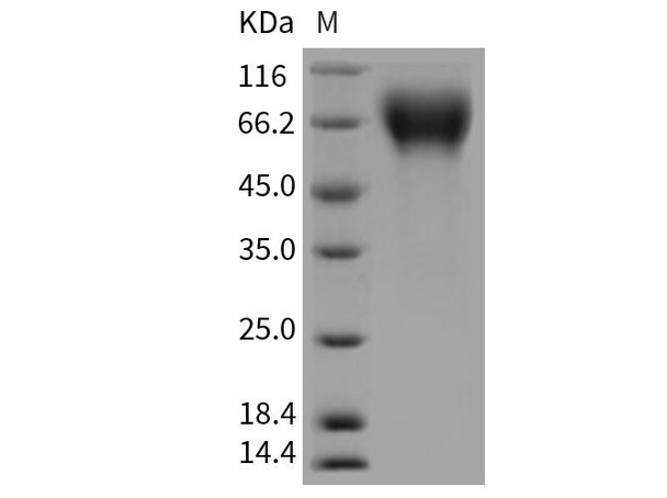 Rat CD6/TP120 Recombinant Protein (RPES4566)