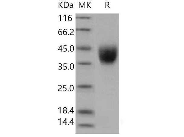 Human IFNGR1 Recombinant Protein (RPES4570)