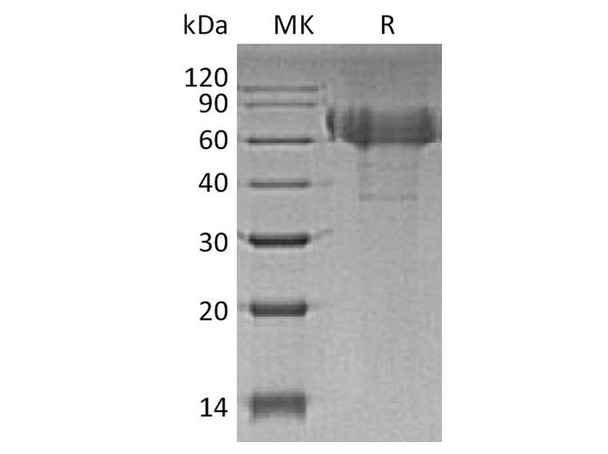 Human TIM4/TIMD4 Recombinant Protein (RPES4602)