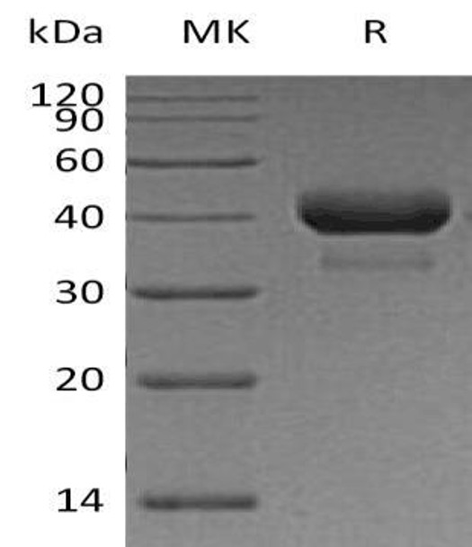 Human Cathepsin B/CTSB Recombinant Protein (RPES4612)