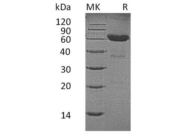 Human CD7/GP40 Recombinant Protein (RPES4623)